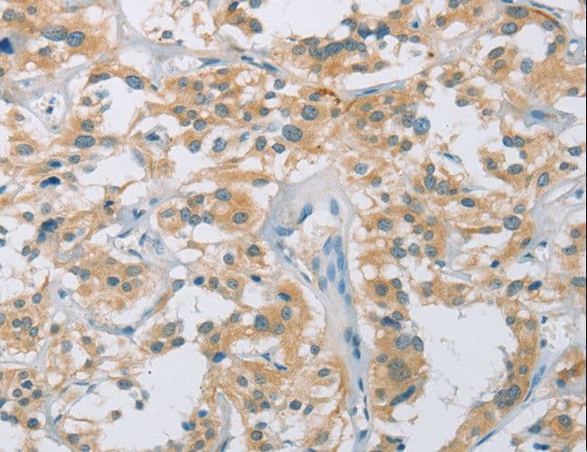 Polyclonal Rabbit anti-Human CYP11B1 Antibody (IHC)
