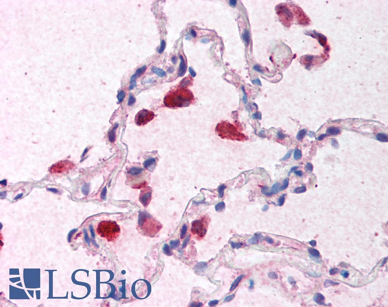 Polyclonal Rabbit anti-Human IFN Beta / Interferon Beta Antibody (IHC, IF, WB)