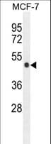ZNF454 Antibody (aa151-179)