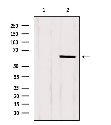 Polyclonal Rabbit anti-Human CKAP4 Antibody (IHC, IF, WB)