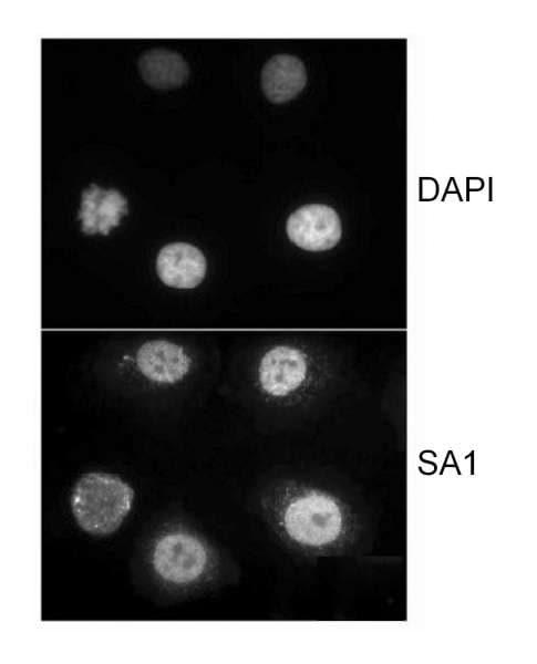 IHC-plus™ STAG1 / SA1 Antibody (aa25-75)