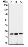 CLDN10 / Claudin 10 Antibody (C-Terminus)
