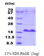 Human MUCL1 Protein (Recombinant His)