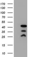 PDLIM2 / SLIM Antibody (clone OTI14D9)