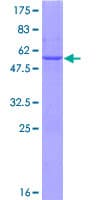 Human BDH2 Protein (Recombinant GST)