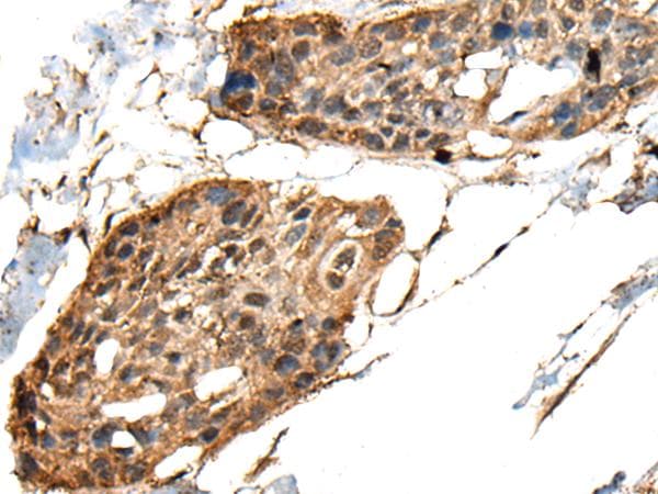 Polyclonal Rabbit anti-Human MCPH1 Antibody (IHC)