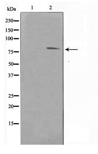 Polyclonal Rabbit anti-Human FER Antibody (WB)