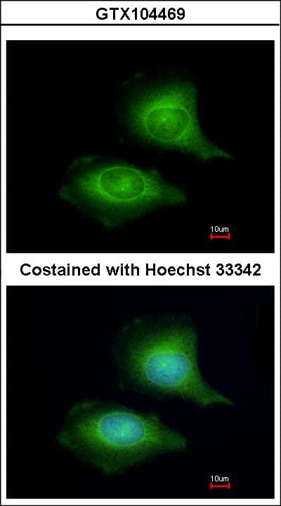 LZTFL1 Antibody (aa1-269)