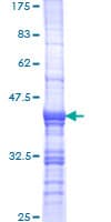 Human INADL / PATJ Protein (Recombinant GST, N-terminus)