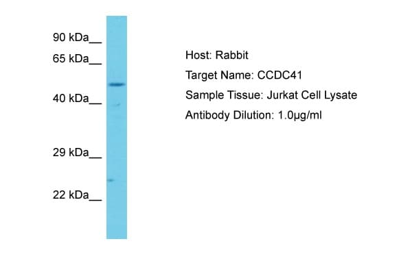 CEP83 / CCDC41 Antibody (aa515-564)