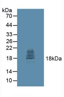 CTLA4 / CD152 Antibody (aa52-211)