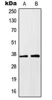 IHC-plus™ HOXA1 Antibody (Internal)