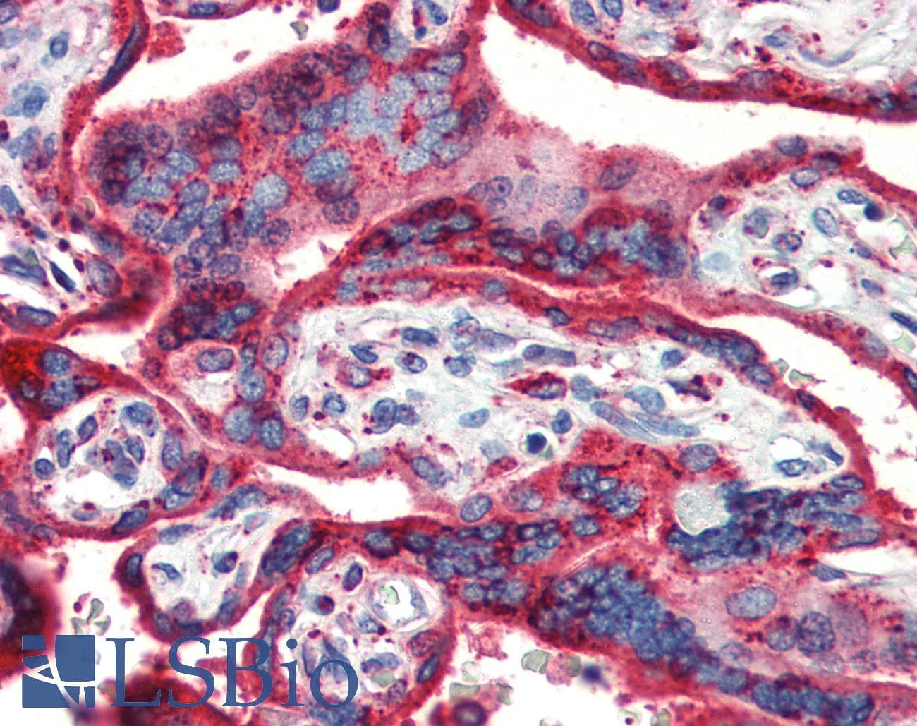 IHC-plus™ HSP90B1 / GP96 / GRP94 Antibody (clone 9G10)