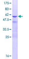 Human CRYBB3 Protein (Recombinant GST)