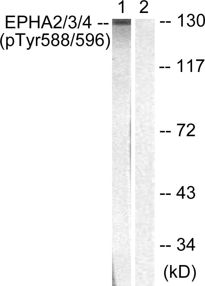 EPH Receptor A2+A3 Antibody (phospho-Tyr588/Tyr596)