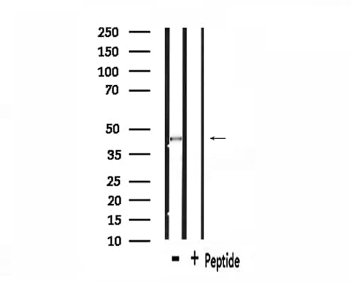 SS18 Antibody