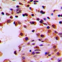 STK36 Antibody