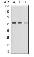 Polyclonal Rabbit anti-Human CHIA / Amcase Antibody (IHC, WB)