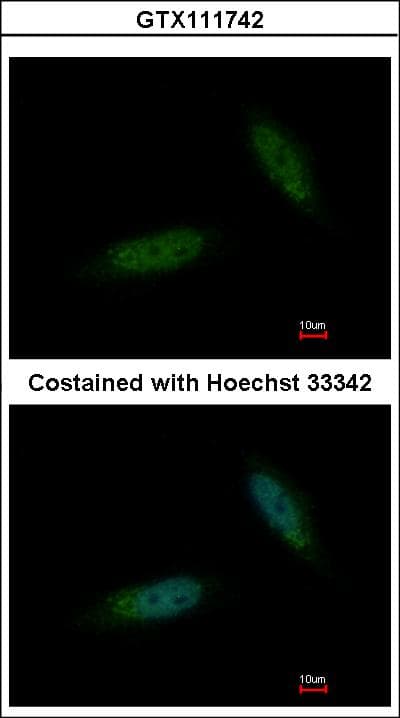 TBCK / TBCKL Antibody (aa457-694)