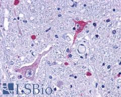 PathPlus™ GPR162 Antibody (Extracellular Domain)