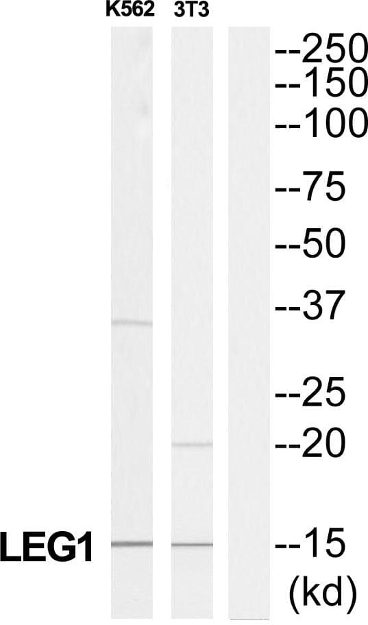 LGALS1 / Galectin 1 Antibody