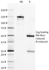 ENO2 / NSE Antibody (clone ENO2/1375)