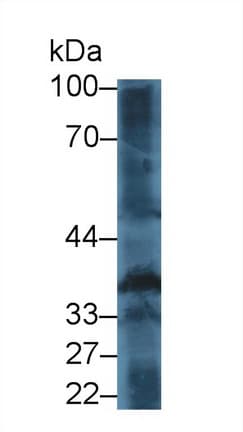 THPO / TPO / Thrombopoietin Antibody (aa22-349)