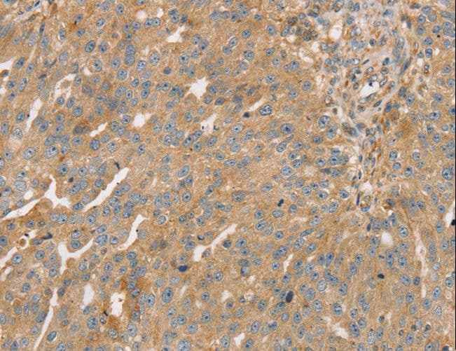 STX16 / Syntaxin 16 Antibody