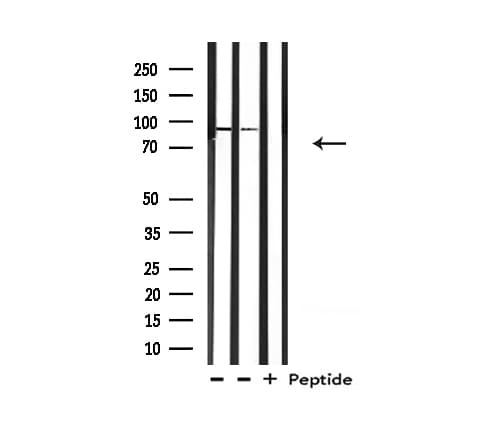 Polyclonal Rabbit anti-Human BCAR3 Antibody (IHC, IF, WB)