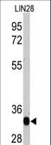 Monoclonal Mouse anti-Human LIN28A / LIN28 Antibody (clone 55CT58.12.1, IHC, IF, WB)