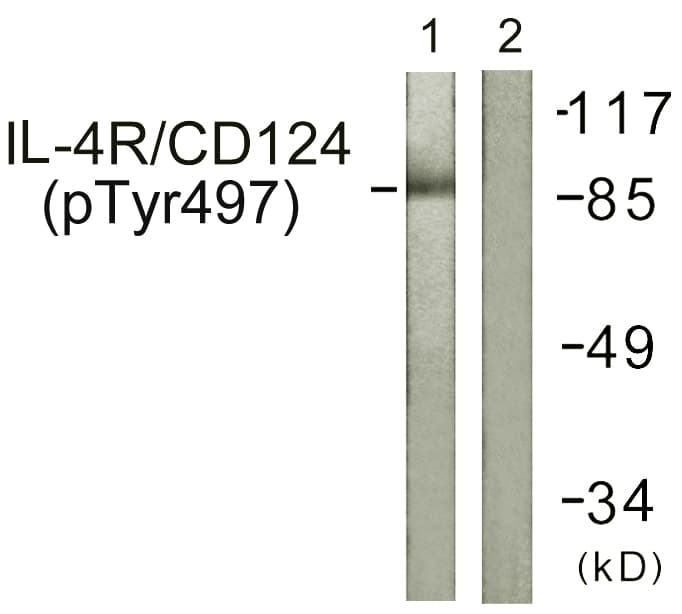 Polyclonal Rabbit anti-Human IL4R / CD124 Antibody (phospho-Tyr497, IF, WB)