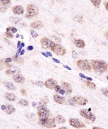 AURKA / Aurora-A Antibody