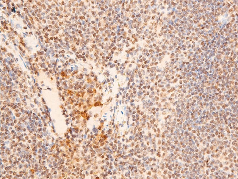 Polyclonal Rabbit anti-Human CHEK2 / CHK2 Antibody (phospho-Thr383, IHC, IF, WB)