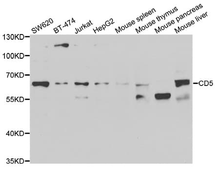 Polyclonal Rabbit anti-Human CD5 Antibody (IHC, WB)