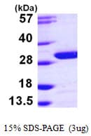 Human UCHL3 Protein (Recombinant His)