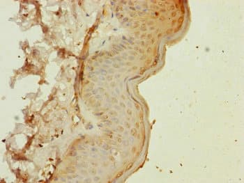Polyclonal Rabbit anti-Human MLC3F / MYL1 Antibody (IHC)