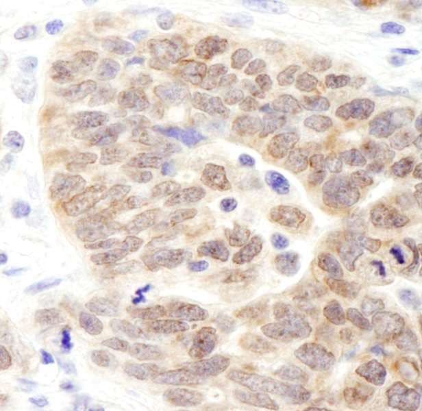 Polyclonal Rabbit anti-Human KDM3B / JMJD1B Antibody (aa1710-C-term, IHC, WB)