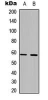 PFKFB2 Antibody (N-Terminus)