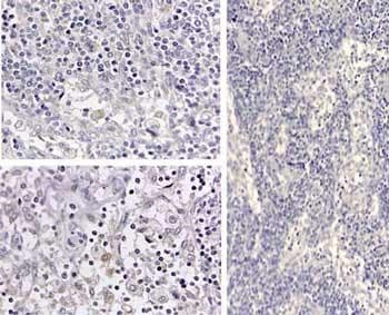 Polyclonal Rabbit anti-Human IL-1B / IL-1 Beta Antibody (N-Terminus, IHC, IF, WB)