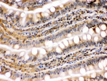 Polyclonal Rabbit anti-Human HSP90 Beta Antibody (IHC, WB)