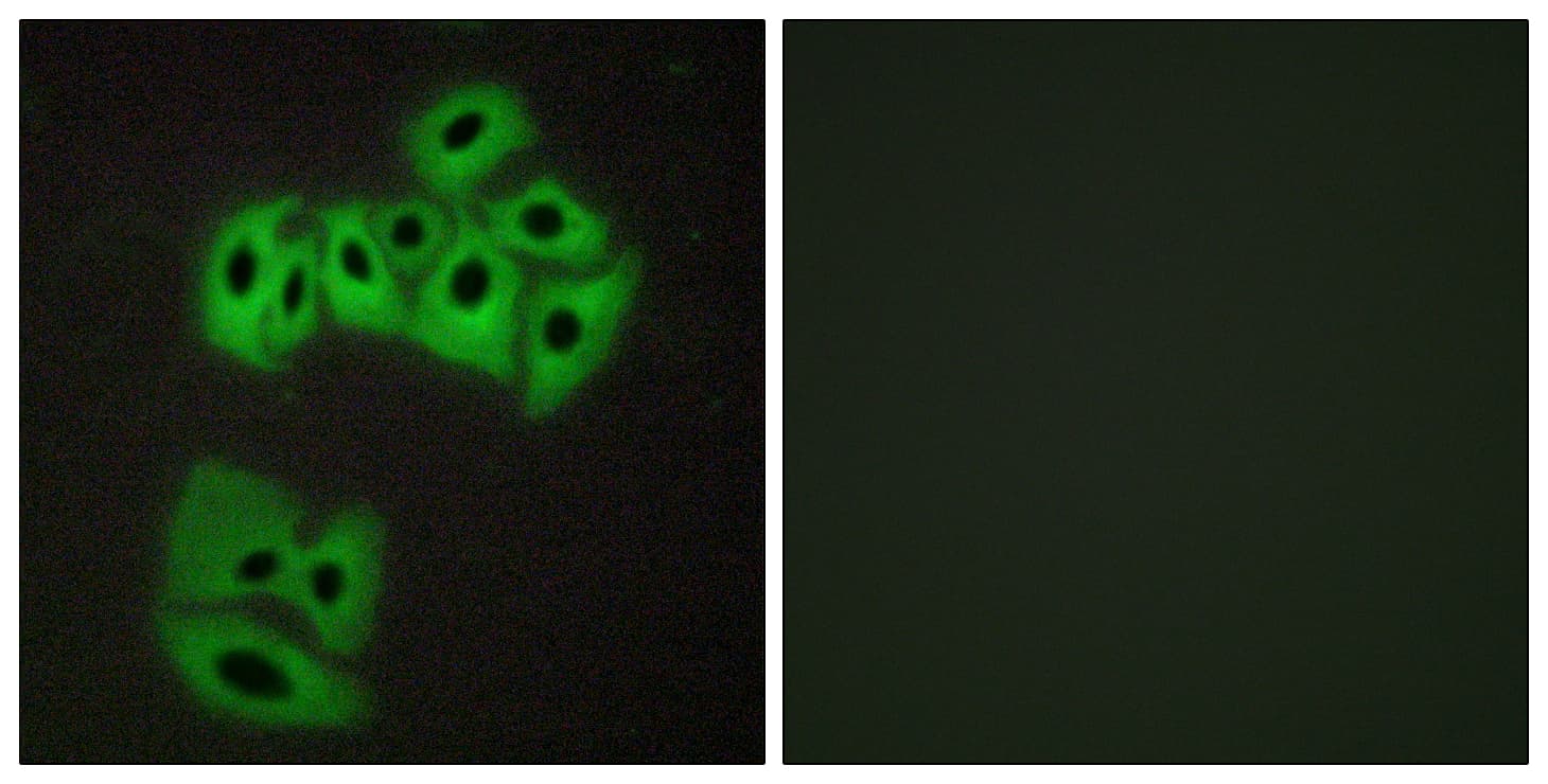 IHC-plus™ VAMP4 / VAMP-4 Antibody (aa1-50)