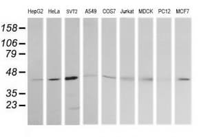 MAP2K1 / MKK1 / MEK1 Antibody (clone OTI8A6, Carrier-free)