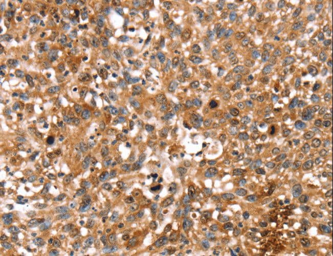 STAR Antibody