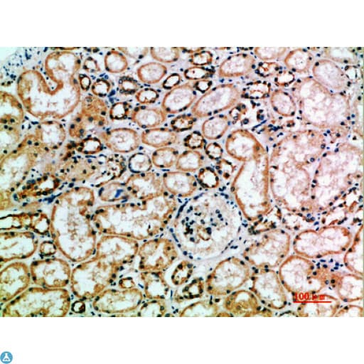 KIR3DL2 Antibody