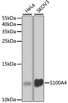 S100A4 / FSP1 Antibody