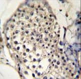 SELV Antibody (aa296-324)