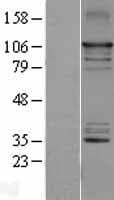 Human MAP3K14 Protein (Over-Expression Lysate Myc-DDK (Flag))