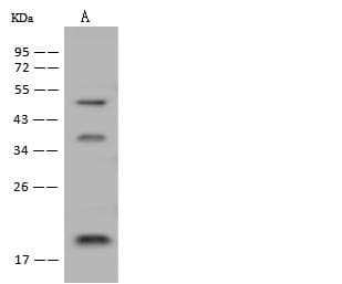 DNAJC24 Antibody