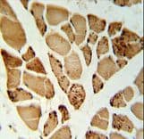 Polyclonal Rabbit anti-Human NT5C1A / CN1A Antibody (aa91-119, IHC, WB)