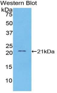 VCAM1 / CD106 Antibody (aa109-318)